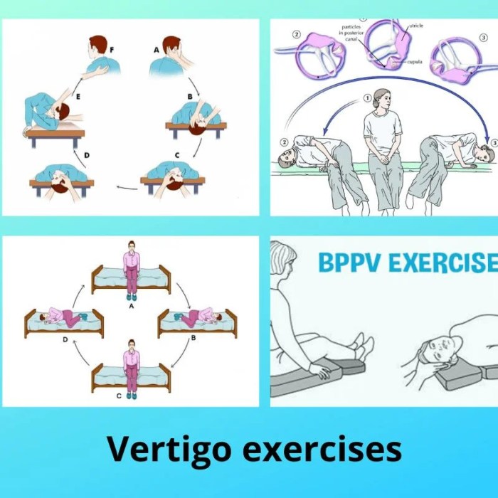 Vertigo exercises dizziness vestibular cervical relief bppv physiotherapy balance remedy natus hr remedies headache neuritis vježbi primjer