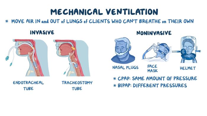 Ventilation mcanique par insufflation